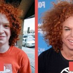 Carrot Top before and after plastic surgery 05
