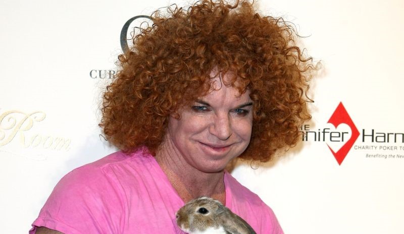 Carrot Top plastic surgery