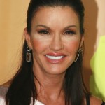 Janice Dickinson after plastic surgery 05