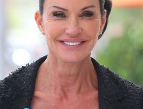 Janice Dickinson after plastic surgery 11