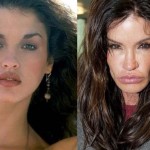 Janice Dickinson before and after plastic surgery 01