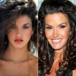 Janice Dickinson before and after plastic surgery 02