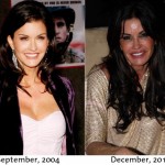 Janice Dickinson before and after plastic surgery 05