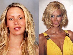 Jenna Jameson before and after plastic surgery