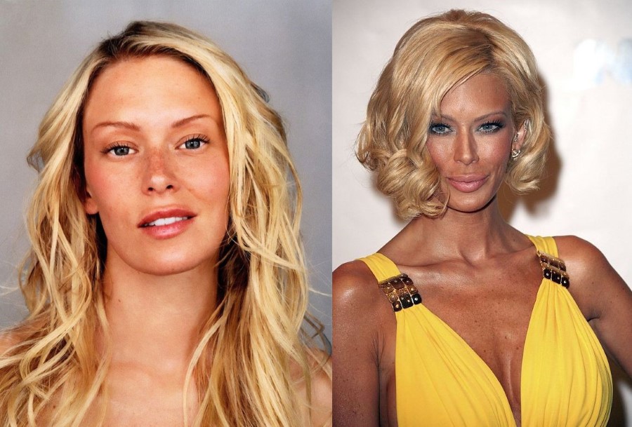 Jenna Jameson before and after plastic surgery.
