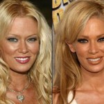 Jenna Jameson before and after plastic surgery 01