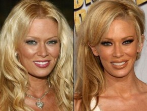 Jenna Jameson before and after plastic surgery 01