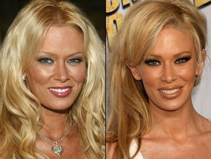 Jenna Jameson before and after plastic surgery 01.