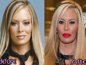 Jenna Jameson before and after plastic surgery