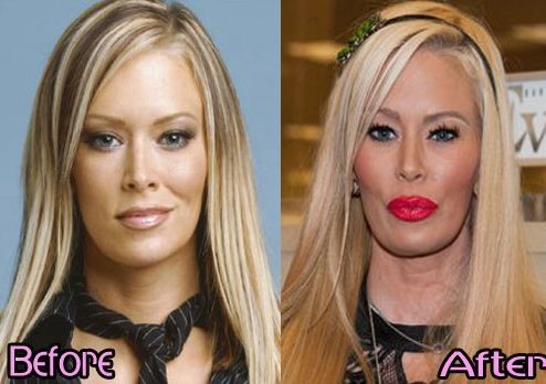 Jenna Jameson before and after plastic surgery