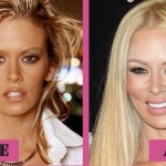 Jenna Jameson before and after plastic surgery 03