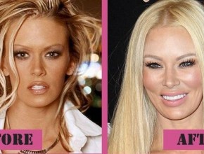 Jenna Jameson before and after plastic surgery 03