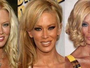 Jenna Jameson before and after plastic surgery 04