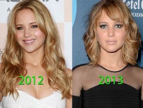 Jennifer Lawrence before and after plastic surgery