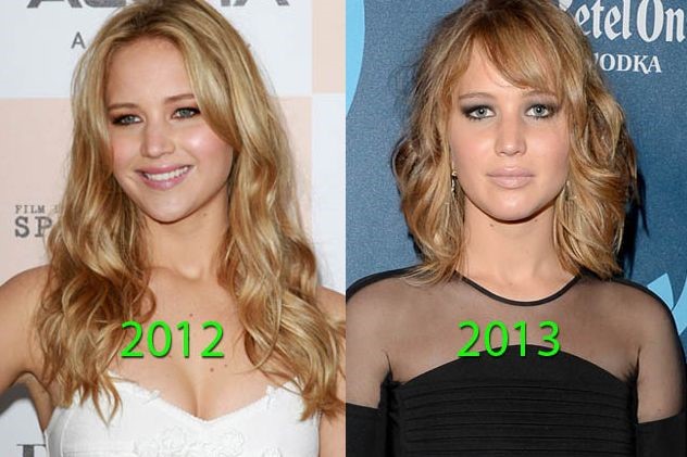 Jennifer Lawrence before and after plastic surgery