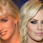 Jenny McCarthy before and after plastic surgery 02