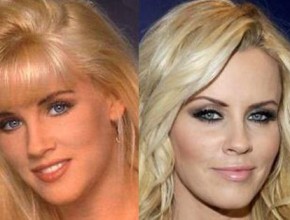Jenny McCarthy before and after plastic surgery 02