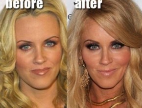 Jenny McCarthy before and after plastic surgery