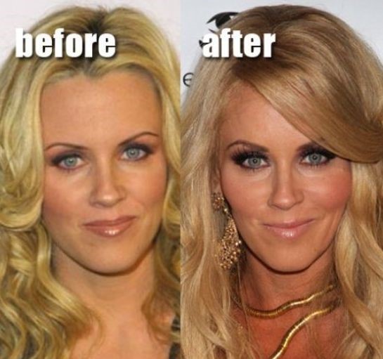Jenny McCarthy before and after plastic surgery