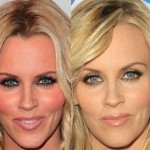 Jenny McCarthy before and after plastic surgery 04