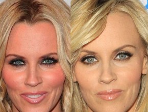 Jenny McCarthy before and after plastic surgery 04