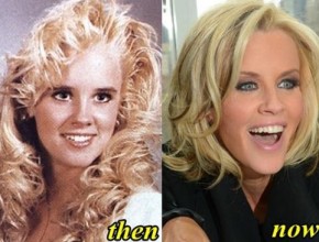 Jenny McCarthy before and after plastic surgery