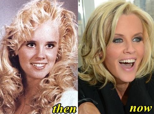 Jenny McCarthy before and after plastic surgery