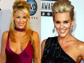 Jenny McCarthy before and after plastic surgery 06