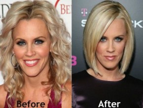 Jenny McCarthy before and after plastic surgery 07