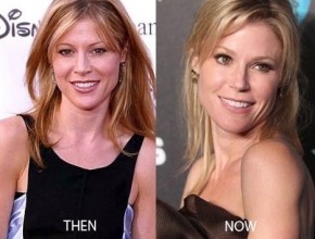 Julie Bowen before and after plastic surgery 02