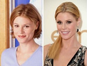 Julie Bowen before and after plastic surgery 03