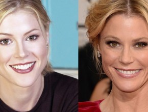 Julie Bowen before and after plastic surgery