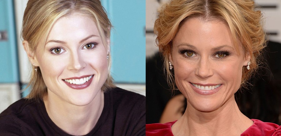 Julie Bowen before and after plastic surgery