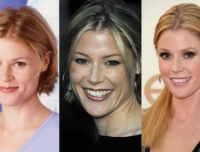 Julie Bowen before and after plastic surgery 05