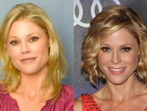 Julie Bowen before and after plastic surgery 06