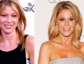 Julie Bowen before and after plastic surgery 07