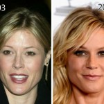 Julie Bowen before and after plastic surgery 08