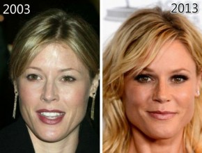 Julie Bowen before and after plastic surgery 08