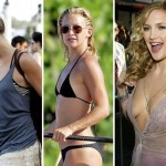 Kate Hudson before and after Plastic surgery 04