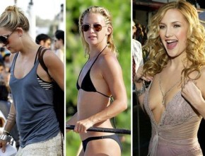 Kate Hudson before and after Plastic surgery 04