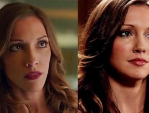 Katie Cassidy before and after plastic surgery 01