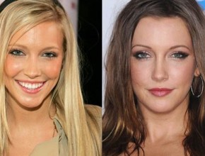 Katie Cassidy before and after plastic surgery