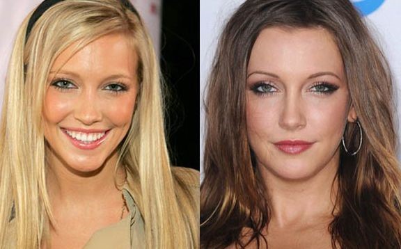 Katie Cassidy before and after plastic surgery