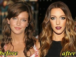 Katie Cassidy before and after plastic surgery