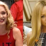 Portia De Rossi before and after plastic surgery 02