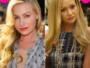 Portia De Rossi before and after plastic surgery