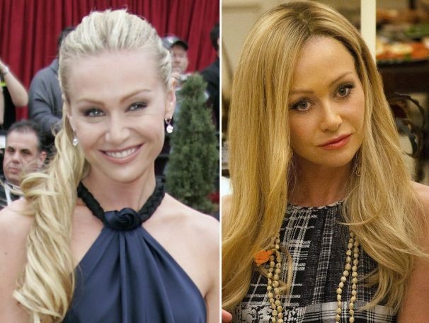 Portia De Rossi before and after plastic surgery