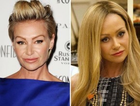 Portia De Rossi before and after plastic surgery