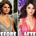 Selena Gomez before and after breast augmentation 01