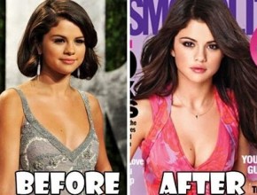 Selena Gomez before and after breast augmentation 01